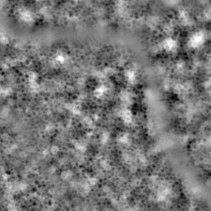 Retinal pigment epithelium cells